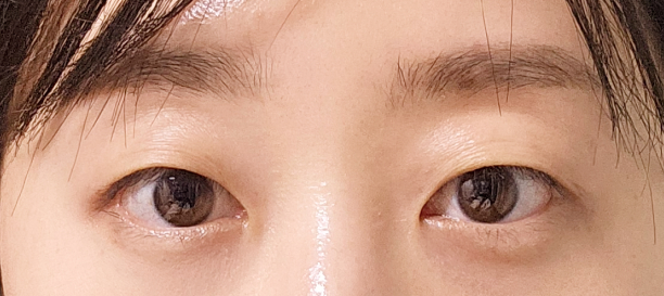 매몰법 before