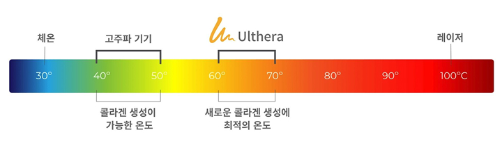 울쎄라 설명이미지 02