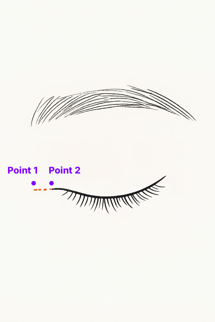Incise the inner corner[b] of the eye.