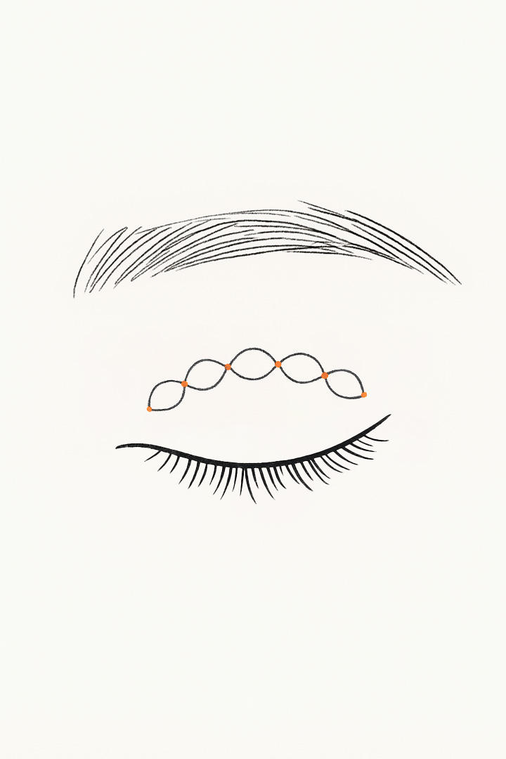 The thread is passed[b] through inner and outer points to secure it.